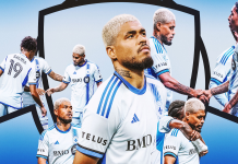 Landon Donovan Hair: Whats the Story Behind His Look? Heres the real deal about it.