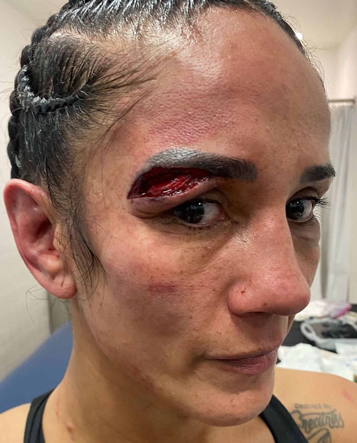 Amanda Serrano Stitches: Find Out Why Shes a Boxing Superstar Now