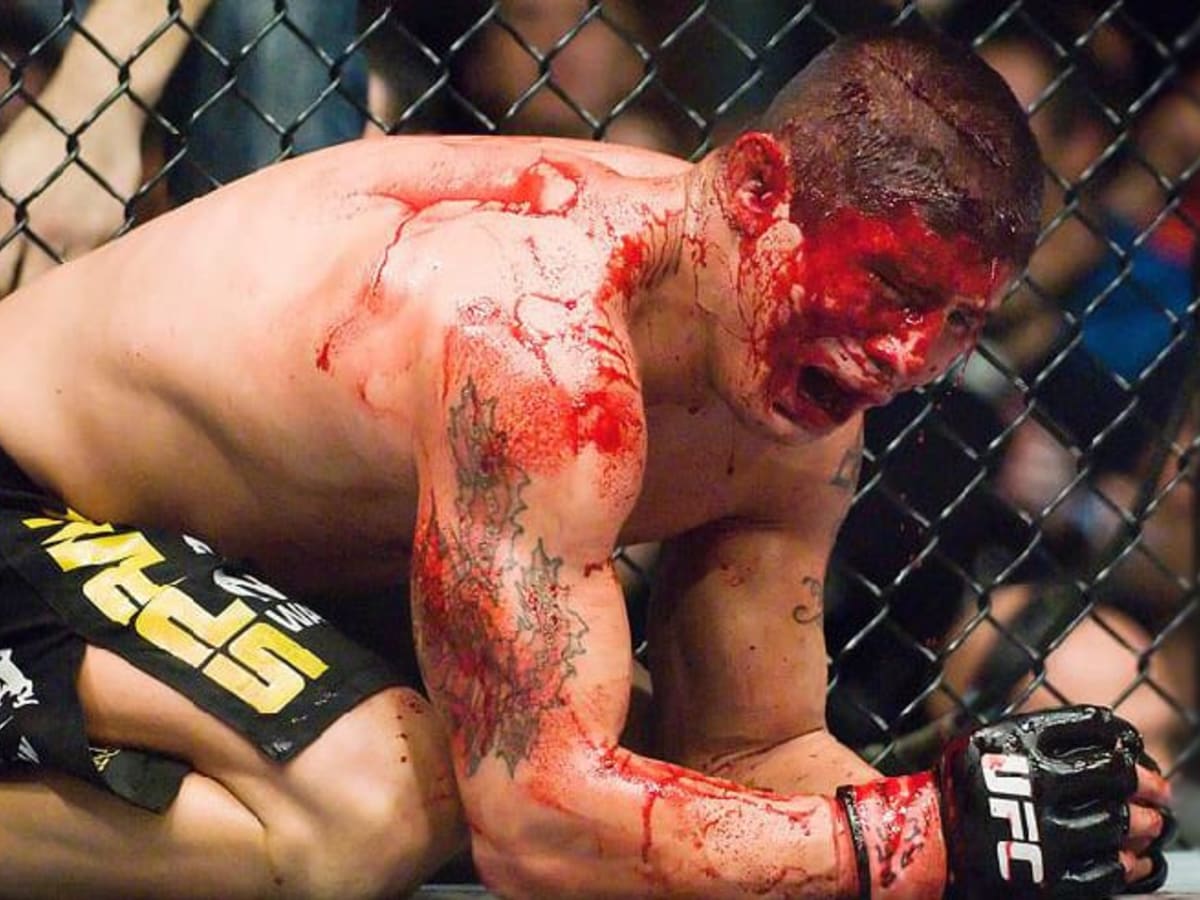 UFC Bloody Fights: See the Goriest Moments in UFC History (Top 5 Ranked)