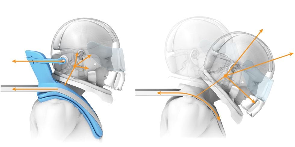 Dale Basilar Skull Fracture: Is it Fatal? Find Out Now