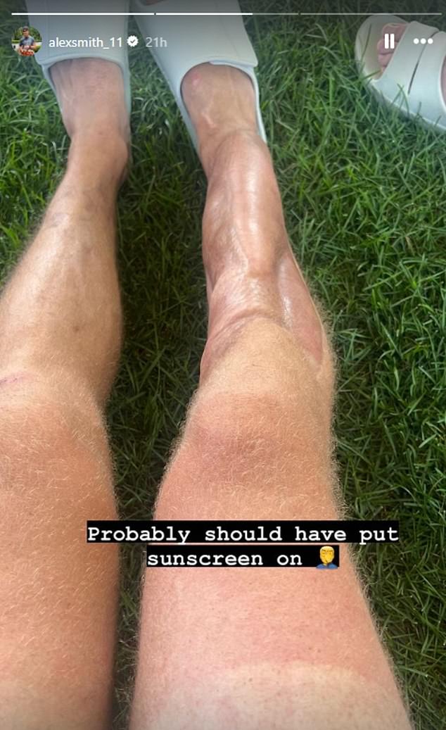 Alex Smiths leg now: Whats the latest on his condition? (Find out the amazing progress he has made)