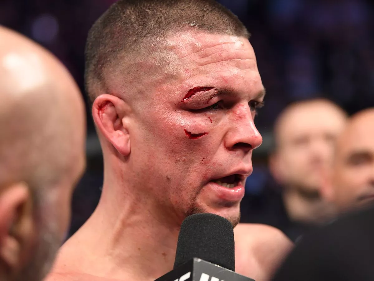 Nate Diaz Face After UFC Fight: Real Bruises and Recovery Details